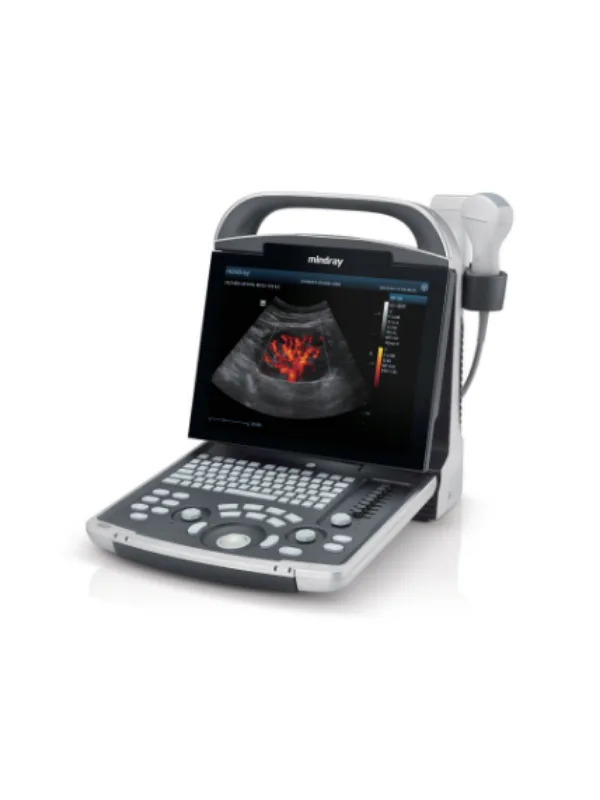 usg-mindray-dp-30
